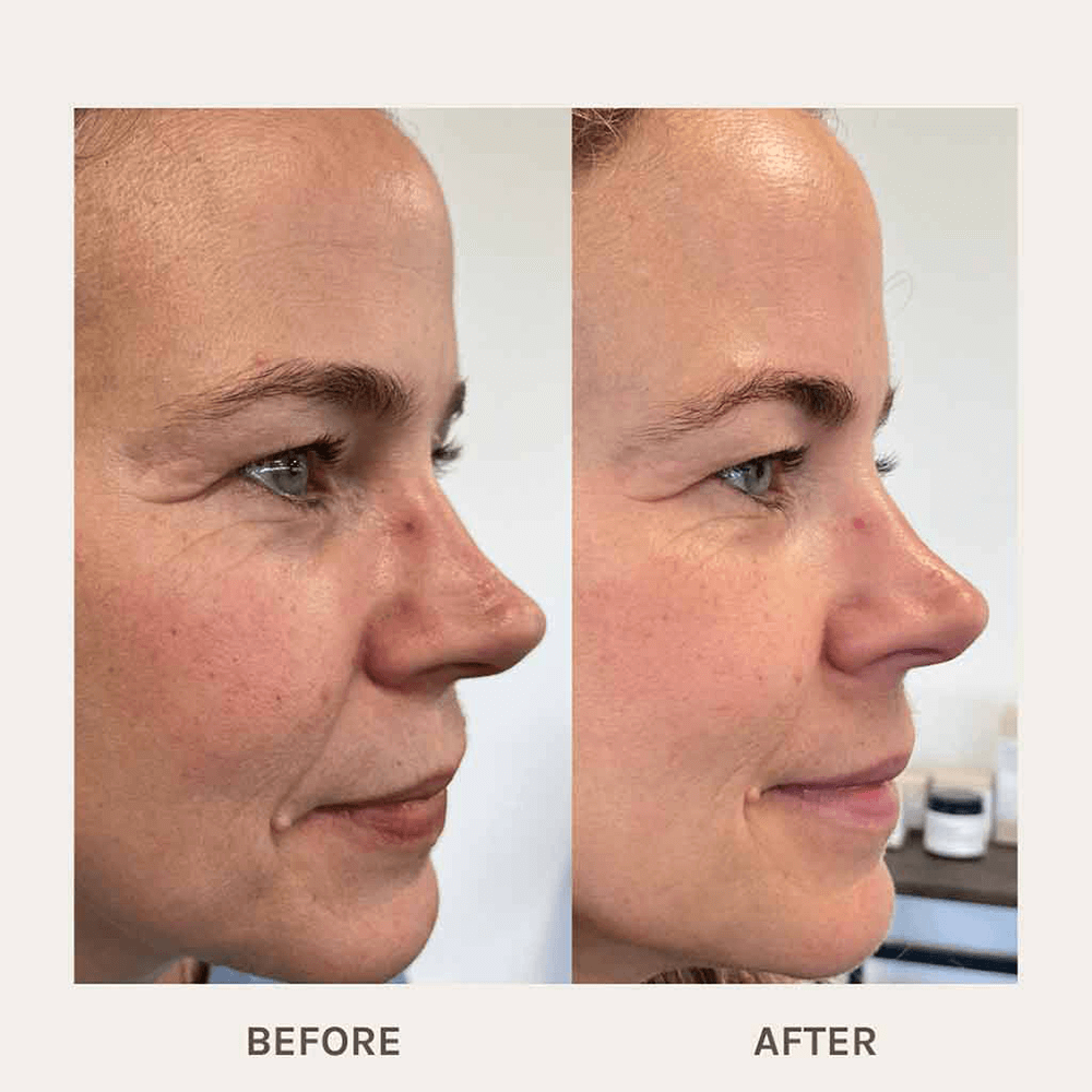 Evolve - Age Defying Lifting Serum, 30 ml