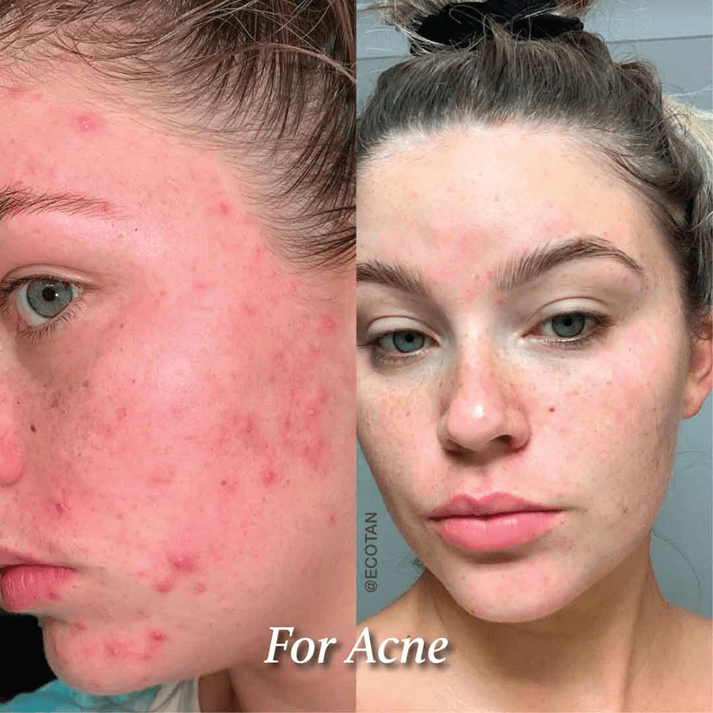 Eco by Sonya - Glory Oil, 30 ml