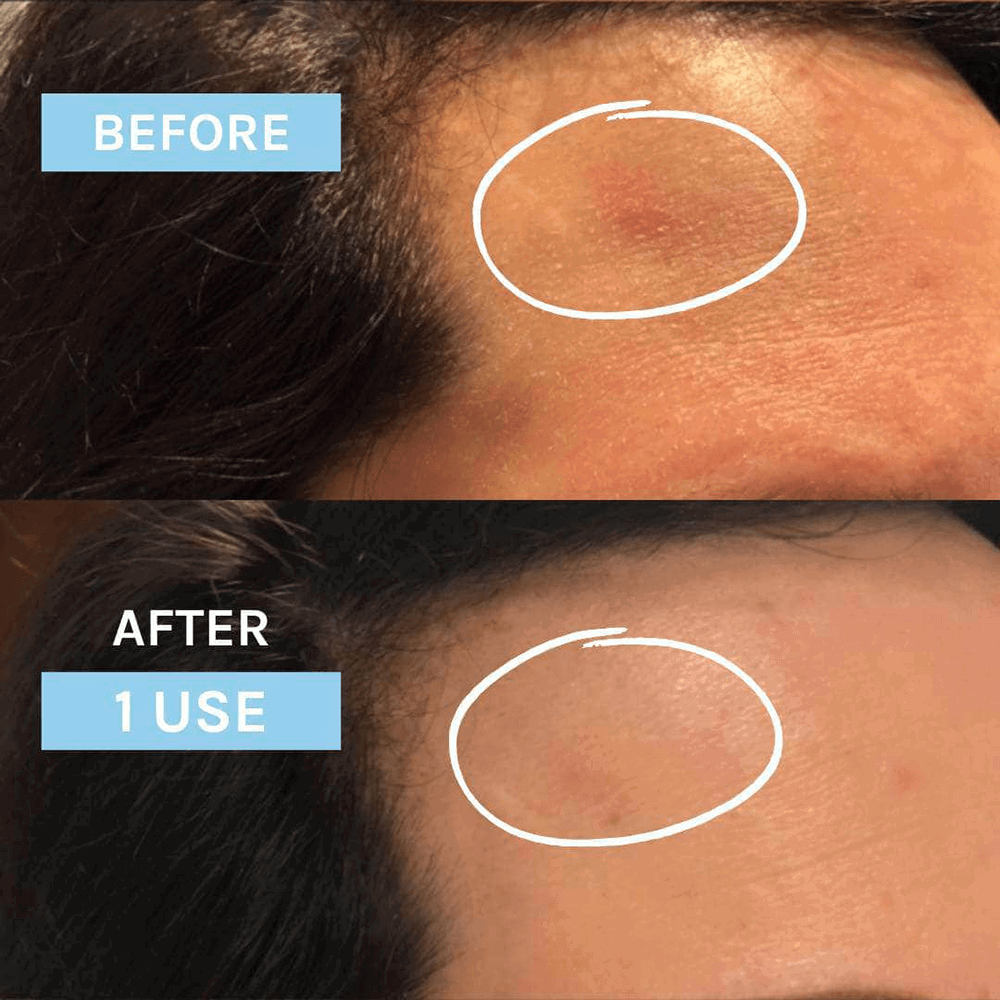 Evolve Blue Velvet Ceramide Serum, 30 ml